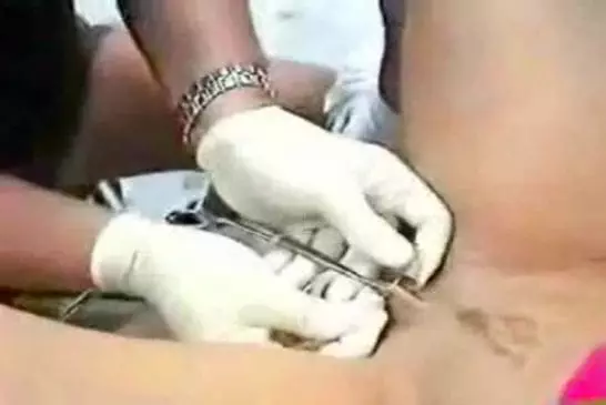 Piercing du clitoris