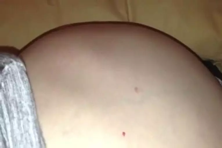 La grossesse ressemble parfois à une scène d'Alien