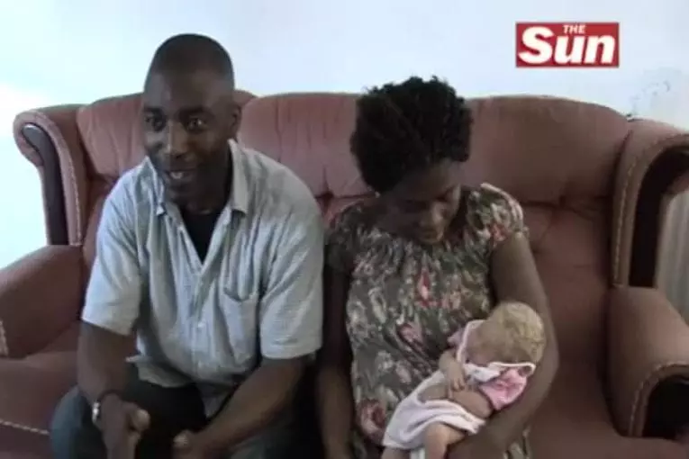 Bébé blanc né de parents noirs