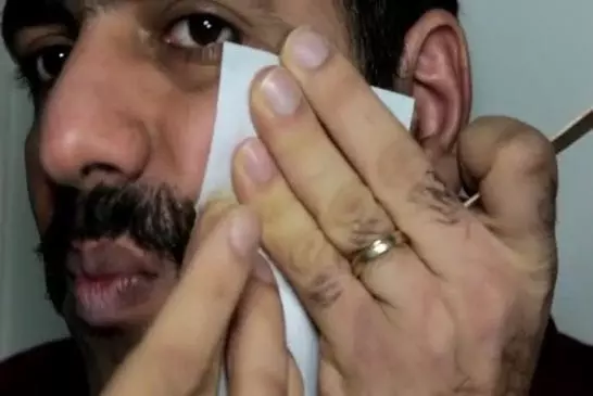 Certaines méthodes d’enlèvement de moustache douloureuses