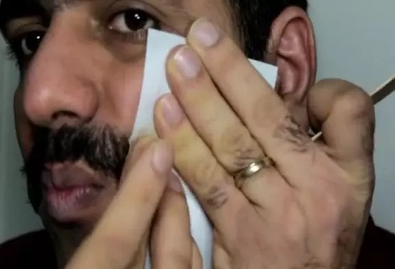 Certaines méthodes d’enlèvement de moustache douloureuses