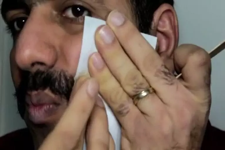 Certaines méthodes d’enlèvement de moustache douloureuses