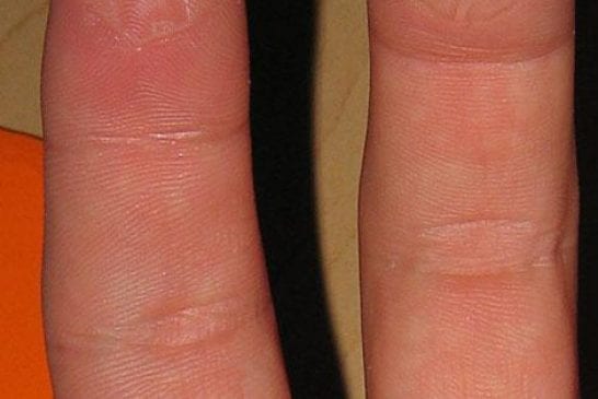 lamprey fingers